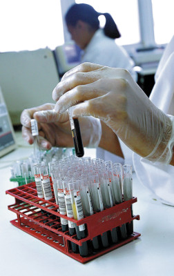 Hemofilia: enfermedad de hombres que portan las mujeres