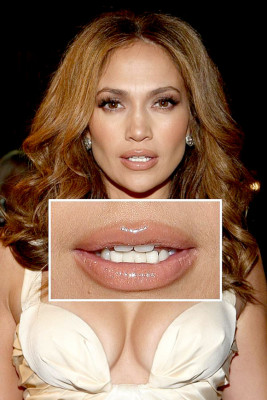 Los descuidos de depilación de las famosas