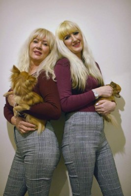 Madre se realiza más de una docena de cirugías para parecerse a su hija