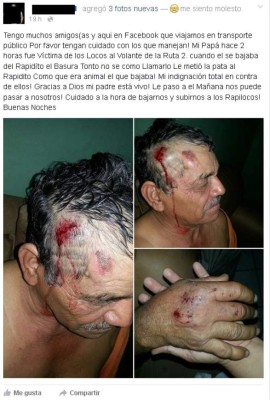 Denuncia: Rapidito casi mata a sexagenario y se da a la fuga