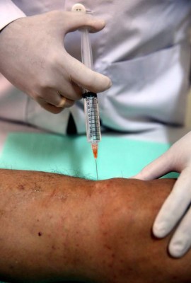 Proloterapia, el tratamiento que regenerará sus articulaciones