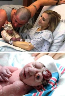 Las 12 fotos censuradas por Facebook