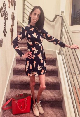 La inspiradora historia detrás de Lizzie Velásquez, la 'mujer más fea del mundo'