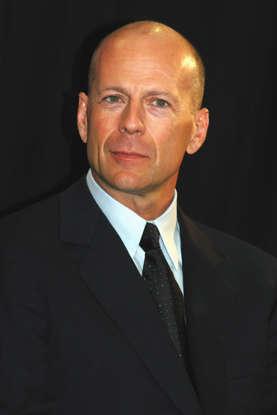 Antes y después: así lucían los famosos calvos