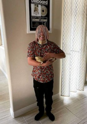 Dan Sur, influencer que asegura que se incrustó cadenas de oro en el cuero cabelludo