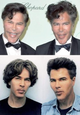 Cirujanos plásticos que hicieron desastres con los famosos