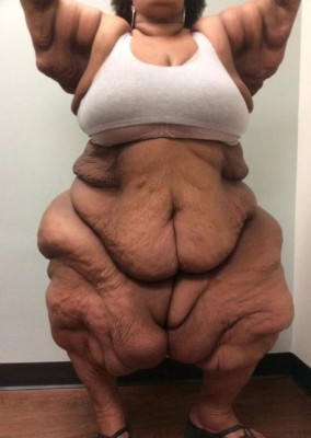 Cuerpo con 230 kilos menos