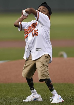 EEUU: Niño con manos trasplantadas quiere jugar fútbol&nbsp;&nbsp;