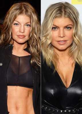 El antes y después de las bubis de las famosas