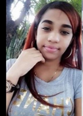 Yocairi Rodríguez, la jovencita atacada con ácido por su expareja