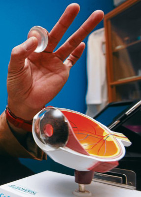 ¿En qué consiste la opacidad del cristalino?