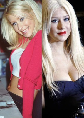 El antes y después de las bubis de las famosas