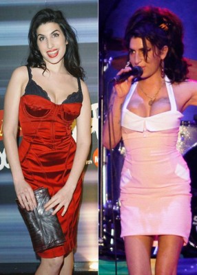 El antes y después de las bubis de las famosas