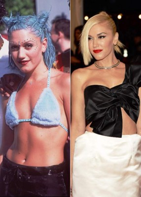 El antes y después de las bubis de las famosas