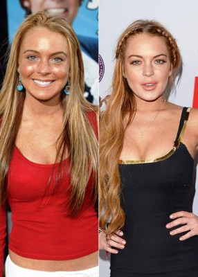 El antes y después de las bubis de las famosas