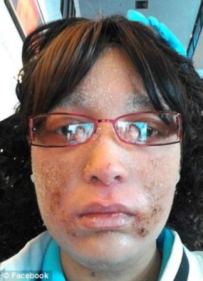 Uñas en vez de pelo