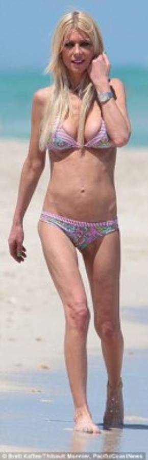 Famosa actriz de Hollywood es víctima de la anorexia