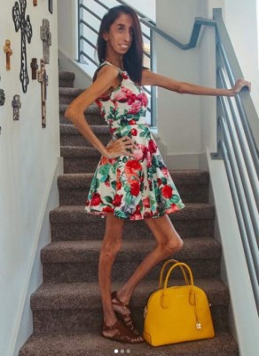 La inspiradora historia detrás de Lizzie Velásquez, la 'mujer más fea del mundo'