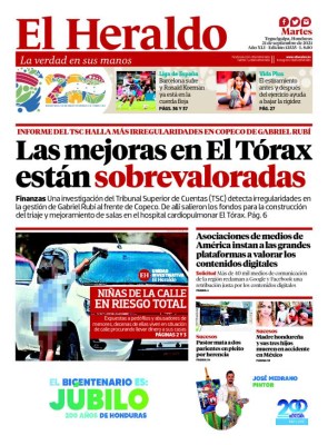 Las mejoras en El Tórax están sobrevaloradas