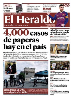 4,000 casos de paperas hay en Honduras