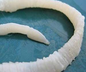 Una desesperada mujer se comió una lombriz para bajar de peso.