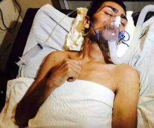 El paciente se encuentra interno en el Hospital Universitario desde el pasado 19 de abril.