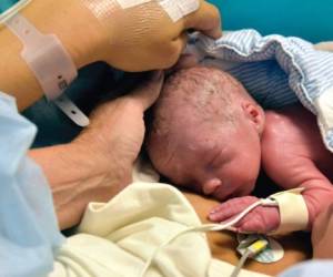 El bebé nació en el hospital de la Universidad de Gothenburg. (Foto: AFP)