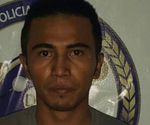 Según el expediente Aguilera Contreras le lanzó una piedra a la joven, ahora está acusado por violencia doméstica y lesiones graves (Foto: MP/ El Heraldo Honduras/ Noticias de Honduras)