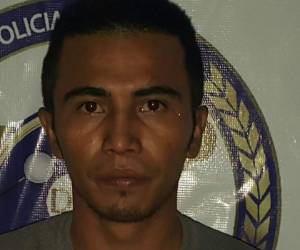 Según el expediente Aguilera Contreras le lanzó una piedra a la joven, ahora está acusado por violencia doméstica y lesiones graves (Foto: MP/ El Heraldo Honduras/ Noticias de Honduras)