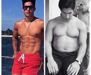 El cantante dijo estar internado en el rodaje de una película.