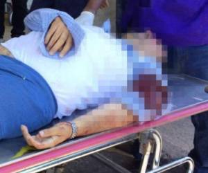 El dirigente de taxistas, Óscar Castillo, fue víctima de un atentado criminal este martes en el barrio Guadalupe. (Foto: Eslalyn Irias).