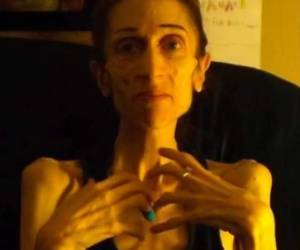 Para salvar su vida, Rachael Farrokh tuvo que pedir ayuda.