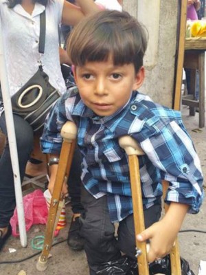 El sorprendente cambio físico del hondureño Marlon Yasir, tras varias cirugías y tratamientos (FOTOS)