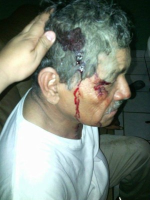 Denuncia: Rapidito casi mata a sexagenario y se da a la fuga