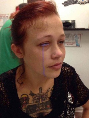 Quería verse diferente, se tatuó los ojos y sufrió las terribles consecuencias