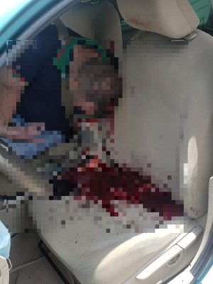 Las sangrientas imágenes que dejó la masacre de Ilama, Santa Bárbara