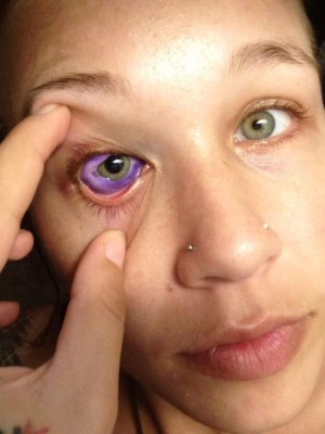 Quería verse diferente, se tatuó los ojos y sufrió las terribles consecuencias
