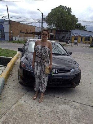 Famosas hondureñas que admitieron públicamente someterse a una cirugía plástica