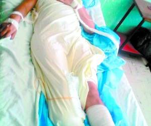 La mujer agredida permanece interna en el hospital Mario Catarino Rivas de San Pedro Sula.