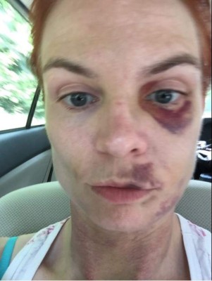 Luchadora de Artes Marciales Mixta muestra su rostro después de perder una batalla