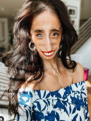 La inspiradora historia detrás de Lizzie Velásquez, la 'mujer más fea del mundo'