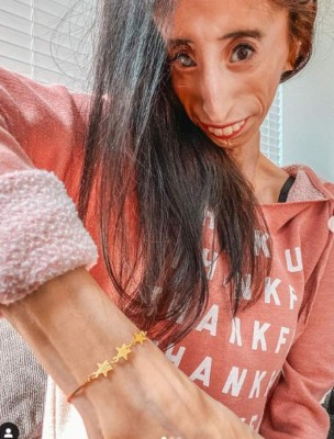 La inspiradora historia detrás de Lizzie Velásquez, la 'mujer más fea del mundo'