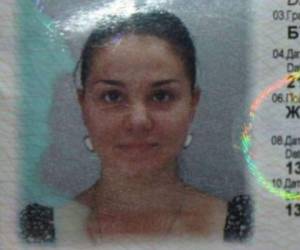 Darya Yurieva fue hospitalizada con graves lesiones en los ojos. Foto: Dnaindia.com