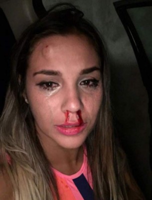 Actriz denuncia golpiza propinada por un bailarín de Ricky Martin