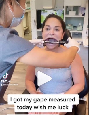 Así es Samantha Ramsdell, la mujer con la boca más grande del mundo