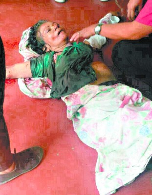 Ataque de dos rottweilers acaba con la vida de una niña