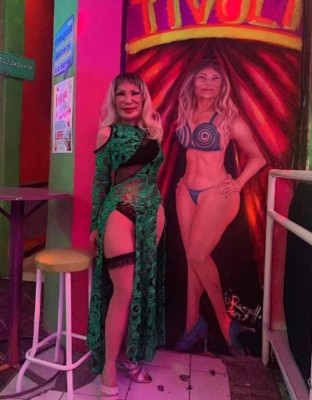 FOTOS: Así era Lyn May antes de ser inyectada con aceite en el rostro