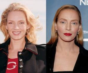 Uma Thurman se sumó a la lista de famosos irreconocibles por el bisturí.