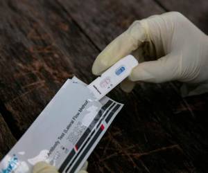 Las autoridades francesas anunciaron la semana pasada el reembolso por la seguridad social de los tests serológicos, algo esperado por la población. Foto: AFP