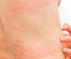 Los médicos cada día intentan descifrar al covid-19 y los efectos que produce sobre los infectados.